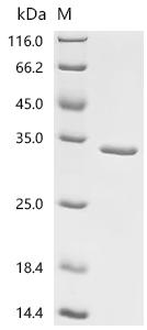 Recombinant Francisella tularensis subsp. holarctica Chaperonin GroEL (groEL) , partial - image 1