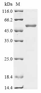 Recombinant Clostridium botulinum Botulinum neurotoxin type E (botE) , partial - image 1