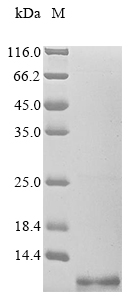 (Tris-Glycine gel) Discontinuous SDS-PAGE (reduced) with 5% enrichment gel and 15% separation gel. (Tris-Glycine gel) Discontinuous SDS-PAGE (reduced) with 5% enrichment gel and 15% separation gel.
