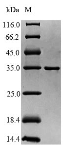 (Tris-Glycine gel) Discontinuous SDS-PAGE (reduced) with 5% enrichment gel and 15% separation gel.