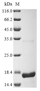 Recombinant Porcine reproductive and respiratory syndrome virus Nucleoprotein (N) - image 1