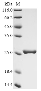 (Tris-Glycine gel) Discontinuous SDS-PAGE (reduced) with 5% enrichment gel and 15% separation gel. (Tris-Glycine gel) Discontinuous SDS-PAGE (reduced) with 5% enrichment gel and 15% separation gel.