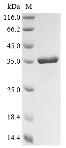 Recombinant Mannheimia haemolytica Leukotoxin (lktA) , partial - image 1