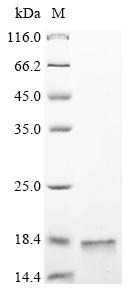 (Tris-Glycine gel) Discontinuous SDS-PAGE (reduced) with 5% enrichment gel and 15% separation gel. (Tris-Glycine gel) Discontinuous SDS-PAGE (reduced) with 5% enrichment gel and 15% separation gel.