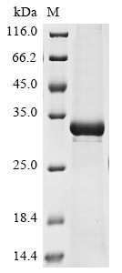 (Tris-Glycine gel) Discontinuous SDS-PAGE (reduced) with 5% enrichment gel and 15% separation gel. (Tris-Glycine gel) Discontinuous SDS-PAGE (reduced) with 5% enrichment gel and 15% separation gel.