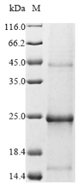 Recombinant Epstein-Barr virus Secreted protein BARF1 (BARF1) - image 1