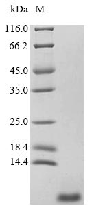 (Tris-Glycine gel) Discontinuous SDS-PAGE (reduced) with 5% enrichment gel and 15% separation gel. (Tris-Glycine gel) Discontinuous SDS-PAGE (reduced) with 5% enrichment gel and 15% separation gel.