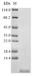 (Tris-Glycine gel) Discontinuous SDS-PAGE (reduced) with 5% enrichment gel and 15% separation gel. (Tris-Glycine gel) Discontinuous SDS-PAGE (reduced) with 5% enrichment gel and 15% separation gel.