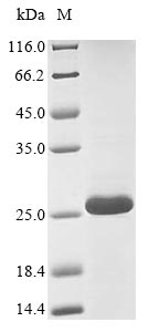 (Tris-Glycine gel) Discontinuous SDS-PAGE (reduced) with 5% enrichment gel and 15% separation gel. (Tris-Glycine gel) Discontinuous SDS-PAGE (reduced) with 5% enrichment gel and 15% separation gel.