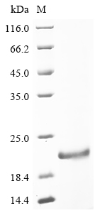 (Tris-Glycine gel) Discontinuous SDS-PAGE (reduced) with 5% enrichment gel and 15% separation gel. (Tris-Glycine gel) Discontinuous SDS-PAGE (reduced) with 5% enrichment gel and 15% separation gel.