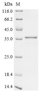 Recombinant Hepatitis delta virus genotype II Large delta antigen - image 1