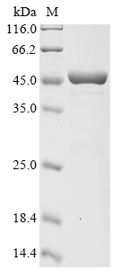 (Tris-Glycine gel) Discontinuous SDS-PAGE (reduced) with 5% enrichment gel and 15% separation gel.