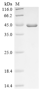 (Tris-Glycine gel) Discontinuous SDS-PAGE (reduced) with 5% enrichment gel and 15% separation gel.