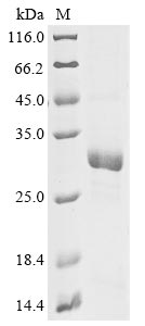 Recombinant Chlamydia trachomatis Virulence plasmid protein pGP3-D - image 1