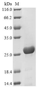 Recombinant Chlamydia trachomatis Virulence plasmid protein pGP3-D - image 1