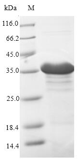 (Tris-Glycine gel) Discontinuous SDS-PAGE (reduced) with 5% enrichment gel and 15% separation gel. (Tris-Glycine gel) Discontinuous SDS-PAGE (reduced) with 5% enrichment gel and 15% separation gel.