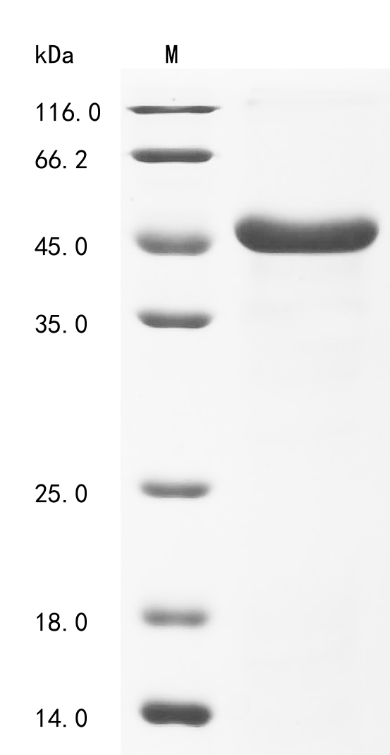 (Tris-Glycine gel) Discontinuous SDS-PAGE (reduced) with 5% enrichment gel and 15% separation gel.