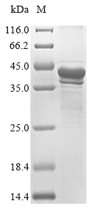 (Tris-Glycine gel) Discontinuous SDS-PAGE (reduced) with 5% enrichment gel and 15% separation gel.