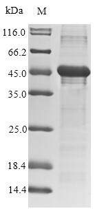 (Tris-Glycine gel) Discontinuous SDS-PAGE (reduced) with 5% enrichment gel and 15% separation gel. (Tris-Glycine gel) Discontinuous SDS-PAGE (reduced) with 5% enrichment gel and 15% separation gel.