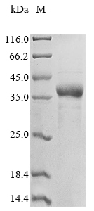 Recombinant Toxoplasma gondII Major surface antigen p30 - image 1