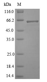 SDS-PAGE- Recombinant protein Lassa N