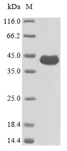 (Tris-Glycine gel) Discontinuous SDS-PAGE (reduced) with 5% enrichment gel and 15% separation gel. (Tris-Glycine gel) Discontinuous SDS-PAGE (reduced) with 5% enrichment gel and 15% separation gel.