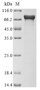 (Tris-Glycine gel) Discontinuous SDS-PAGE (reduced) with 5% enrichment gel and 15% separation gel. (Tris-Glycine gel) Discontinuous SDS-PAGE (reduced) with 5% enrichment gel and 15% separation gel.
