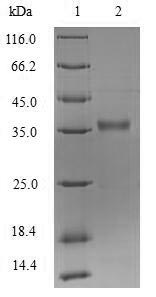 (Tris-Glycine gel) Discontinuous SDS-PAGE (reduced) with 5% enrichment gel and 15% separation gel. (Tris-Glycine gel) Discontinuous SDS-PAGE (reduced) with 5% enrichment gel and 15% separation gel.