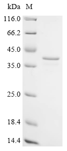 (Tris-Glycine gel) Discontinuous SDS-PAGE (reduced) with 5% enrichment gel and 15% separation gel.