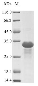 SDS-PAGE- Recombinant protein Epstein-Barr EBNA3