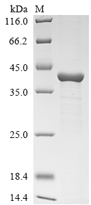 (Tris-Glycine gel) Discontinuous SDS-PAGE (reduced) with 5% enrichment gel and 15% separation gel.