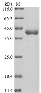 (Tris-Glycine gel) Discontinuous SDS-PAGE (reduced) with 5% enrichment gel and 15% separation gel.