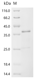 Recombinant Epstein-Barr virus Epstein-Barr nuclear antigen 2 (EBNA2) , partial - image 1