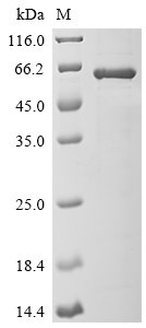 Recombinant Chandipura virus Glycoprotein G (G) , partial - image 1