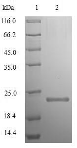 (Tris-Glycine gel) Discontinuous SDS-PAGE (reduced) with 5% enrichment gel and 15% separation gel. (Tris-Glycine gel) Discontinuous SDS-PAGE (reduced) with 5% enrichment gel and 15% separation gel.
