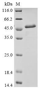 (Tris-Glycine gel) Discontinuous SDS-PAGE (reduced) with 5% enrichment gel and 15% separation gel. (Tris-Glycine gel) Discontinuous SDS-PAGE (reduced) with 5% enrichment gel and 15% separation gel.