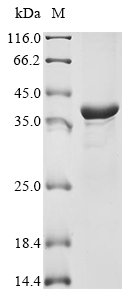 (Tris-Glycine gel) Discontinuous SDS-PAGE (reduced) with 5% enrichment gel and 15% separation gel.