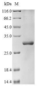 (Tris-Glycine gel) Discontinuous SDS-PAGE (reduced) with 5% enrichment gel and 15% separation gel. (Tris-Glycine gel) Discontinuous SDS-PAGE (reduced) with 5% enrichment gel and 15% separation gel.