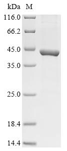 (Tris-Glycine gel) Discontinuous SDS-PAGE (reduced) with 5% enrichment gel and 15% separation gel.
