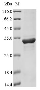 (Tris-Glycine gel) Discontinuous SDS-PAGE (reduced) with 5% enrichment gel and 15% separation gel. (Tris-Glycine gel) Discontinuous SDS-PAGE (reduced) with 5% enrichment gel and 15% separation gel.
