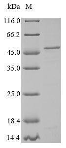 (Tris-Glycine gel) Discontinuous SDS-PAGE (reduced) with 5% enrichment gel and 15% separation gel. (Tris-Glycine gel) Discontinuous SDS-PAGE (reduced) with 5% enrichment gel and 15% separation gel.