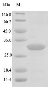 (Tris-Glycine gel) Discontinuous SDS-PAGE (reduced) with 5% enrichment gel and 15% separation gel. (Tris-Glycine gel) Discontinuous SDS-PAGE (reduced) with 5% enrichment gel and 15% separation gel.