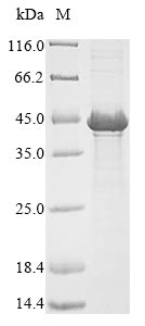(Tris-Glycine gel) Discontinuous SDS-PAGE (reduced) with 5% enrichment gel and 15% separation gel. (Tris-Glycine gel) Discontinuous SDS-PAGE (reduced) with 5% enrichment gel and 15% separation gel.