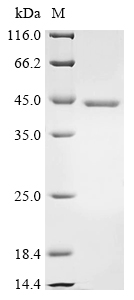 (Tris-Glycine gel) Discontinuous SDS-PAGE (reduced) with 5% enrichment gel and 15% separation gel. (Tris-Glycine gel) Discontinuous SDS-PAGE (reduced) with 5% enrichment gel and 15% separation gel.
