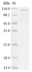 Recombinant Potato leafroll virus Protein P1-P2, partial - image 1
