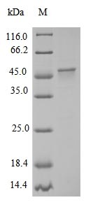 (Tris-Glycine gel) Discontinuous SDS-PAGE (reduced) with 5% enrichment gel and 15% separation gel. (Tris-Glycine gel) Discontinuous SDS-PAGE (reduced) with 5% enrichment gel and 15% separation gel.
