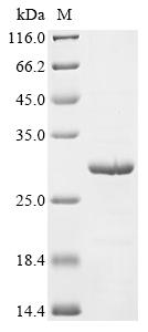 (Tris-Glycine gel) Discontinuous SDS-PAGE (reduced) with 5% enrichment gel and 15% separation gel.