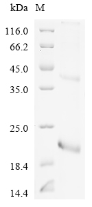 (Tris-Glycine gel) Discontinuous SDS-PAGE (reduced) with 5% enrichment gel and 15% separation gel. (Tris-Glycine gel) Discontinuous SDS-PAGE (reduced) with 5% enrichment gel and 15% separation gel.