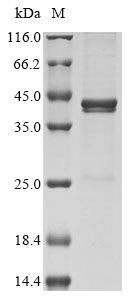 (Tris-Glycine gel) Discontinuous SDS-PAGE (reduced) with 5% enrichment gel and 15% separation gel. (Tris-Glycine gel) Discontinuous SDS-PAGE (reduced) with 5% enrichment gel and 15% separation gel.