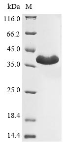 (Tris-Glycine gel) Discontinuous SDS-PAGE (reduced) with 5% enrichment gel and 15% separation gel.